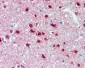 CBR3 Antibody (clone AT3C5)
